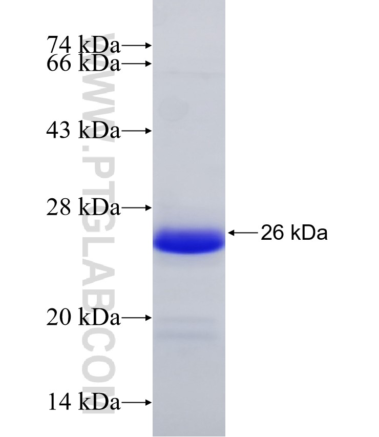 GPR151 fusion protein Ag32415 SDS-PAGE GPR151 fusion protein Ag32415 SDS-PAGE
