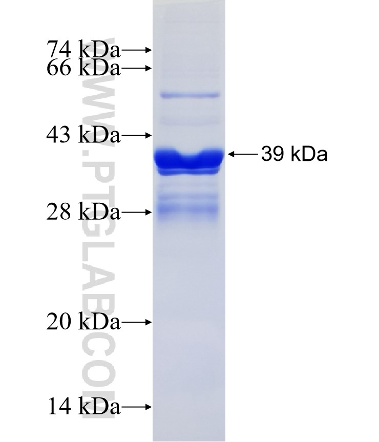 GPR160 fusion protein Ag14661 SDS-PAGE GPR160 fusion protein Ag14661 SDS-PAGE