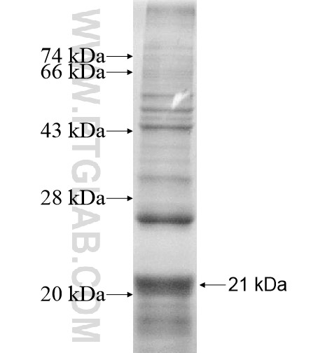 GPR160 fusion protein Ag14808 SDS-PAGE GPR160 fusion protein Ag14808 SDS-PAGE