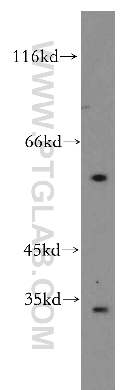 WB analysis of SH-SY5Y using 15254-1-AP