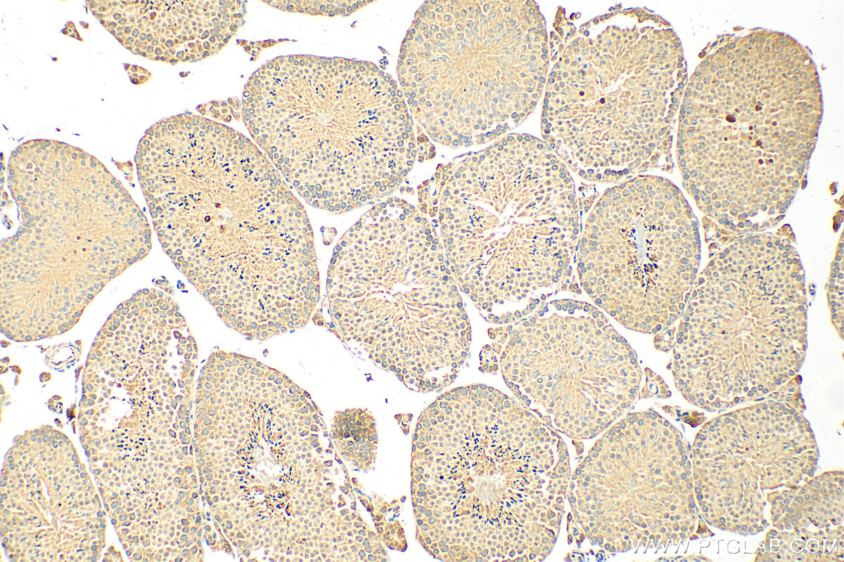 IHC staining of mouse testis using 20791-1-AP (same clone as 20791-1-PBS) IHC staining of mouse testis using 20791-1-AP (same clone as 20791-1-PBS)