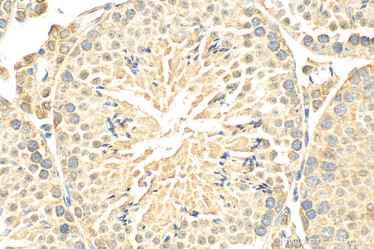 IHC staining of mouse testis using 20791-1-AP