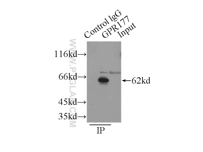 IP experiment of mouse liver using 17950-1-AP