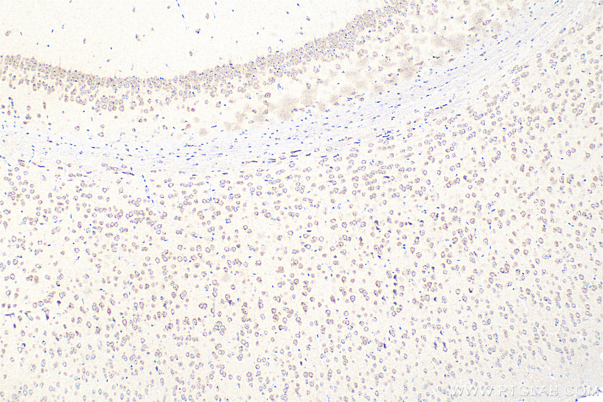 Immunohistochemical analysis of paraffin-embedded mouse brain tissue slide using 12377-1-AP (GPR183/EBI2 antibody) at dilution of 1:200 (under 10x lens). Heat mediated antigen retrieval with Tris-EDTA buffer (pH 9.0). IHC staining of mouse brain using 12377-1-AP