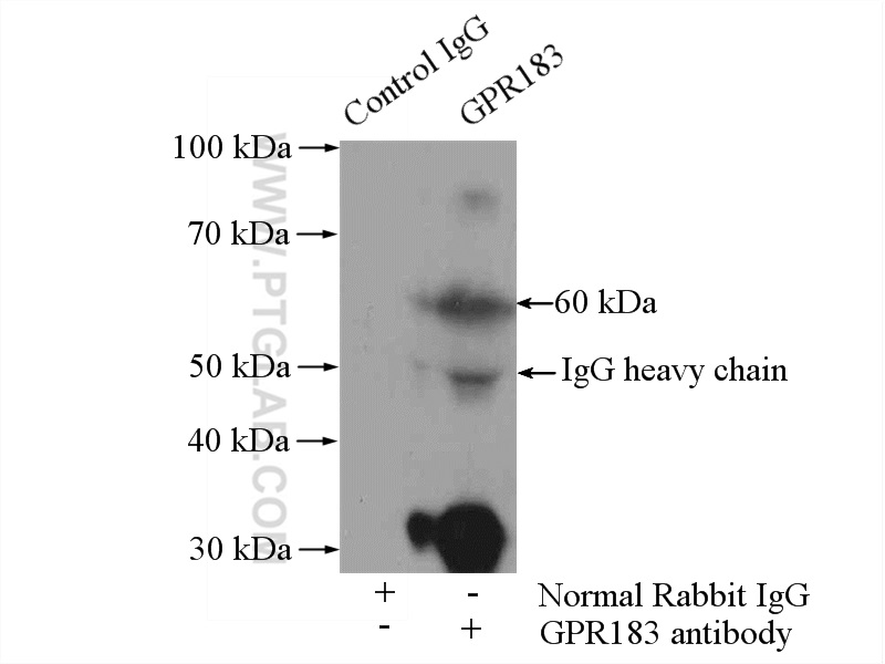 IP experiment of mouse lung using 12377-1-AP