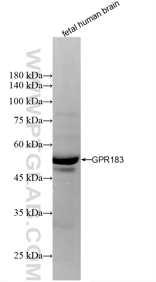 WB analysis using 87492-3-RR