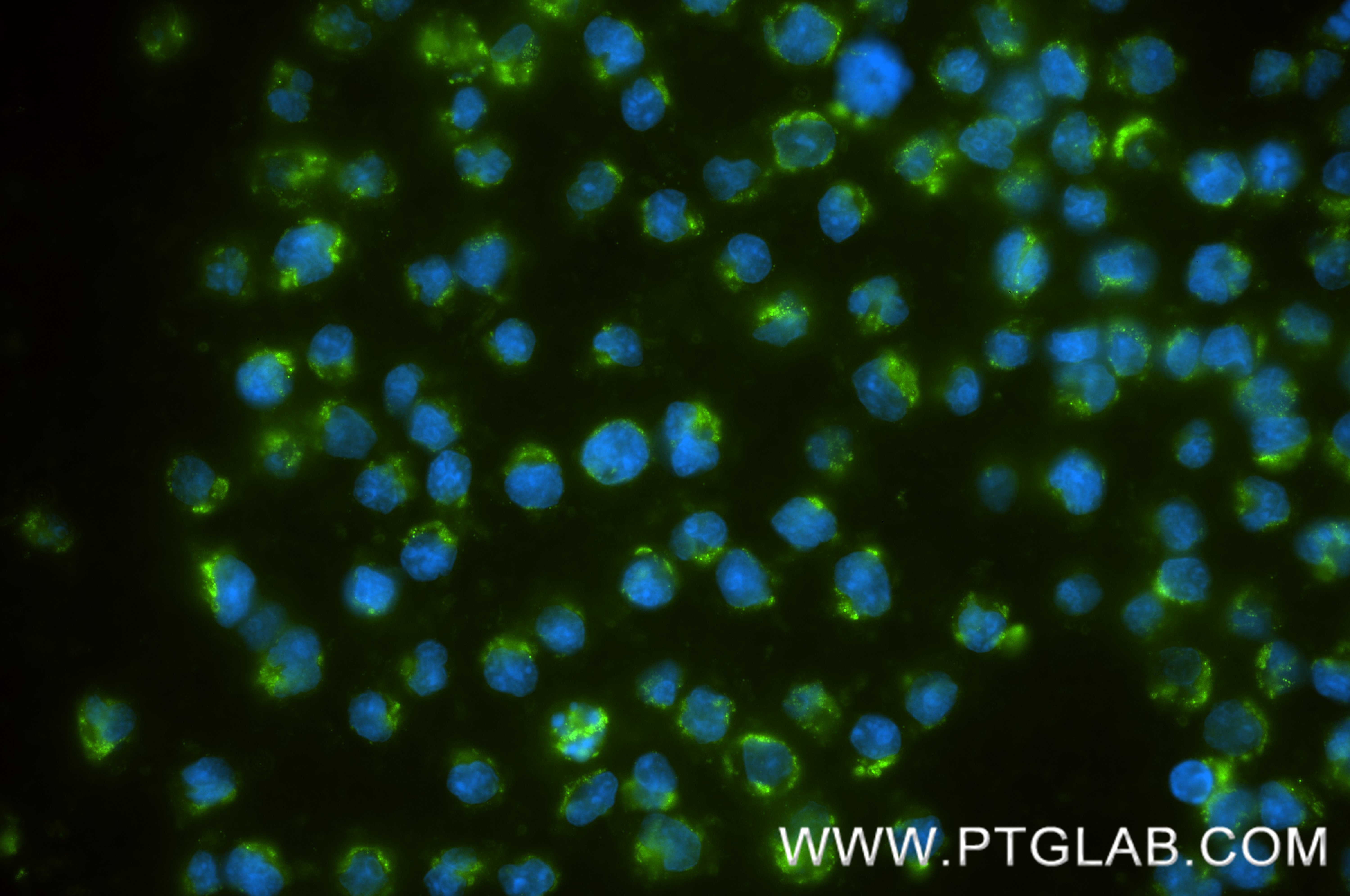 IF Staining of Daudi using 87492-4-RR (same clone as 87492-4-PBS)
