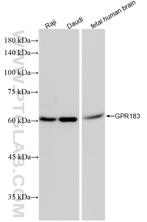 WB analysis using 87492-4-RR (same clone as 87492-4-PBS)
