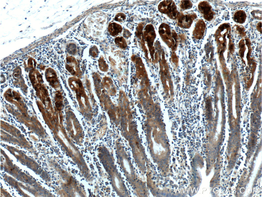 IHC staining of human stomach using 17973-1-AP