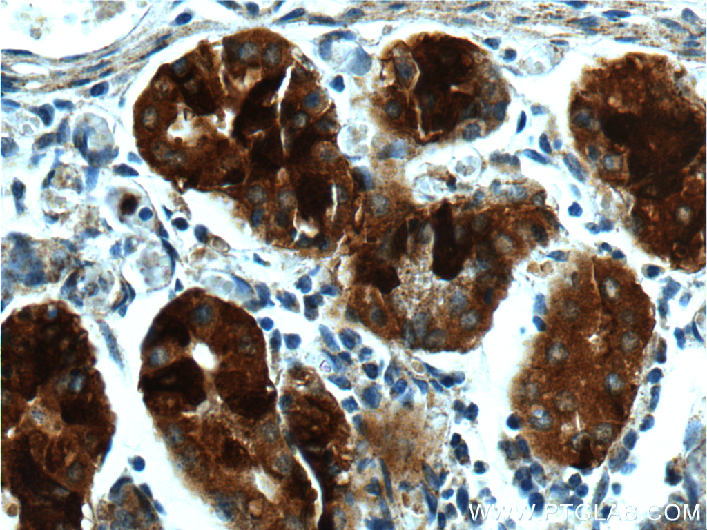 IHC staining of human stomach using 17973-1-AP