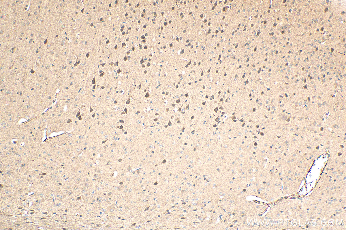 IHC staining of mouse brain using 20847-1-AP