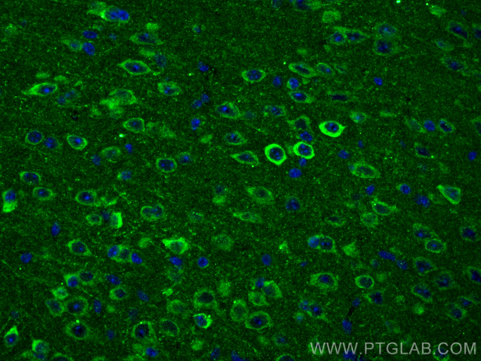 IF Staining of mouse brain using 14820-1-AP
