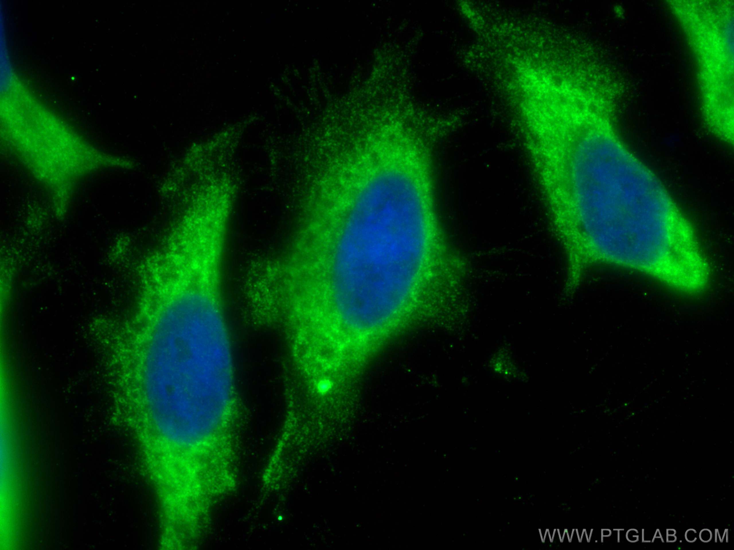 IF Staining of HeLa using 14820-1-AP