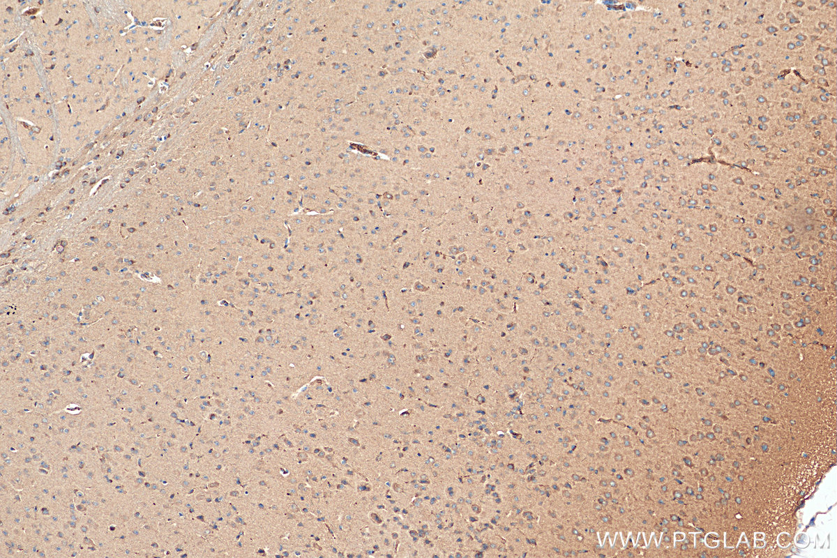 IHC staining of mouse brain using 14820-1-AP