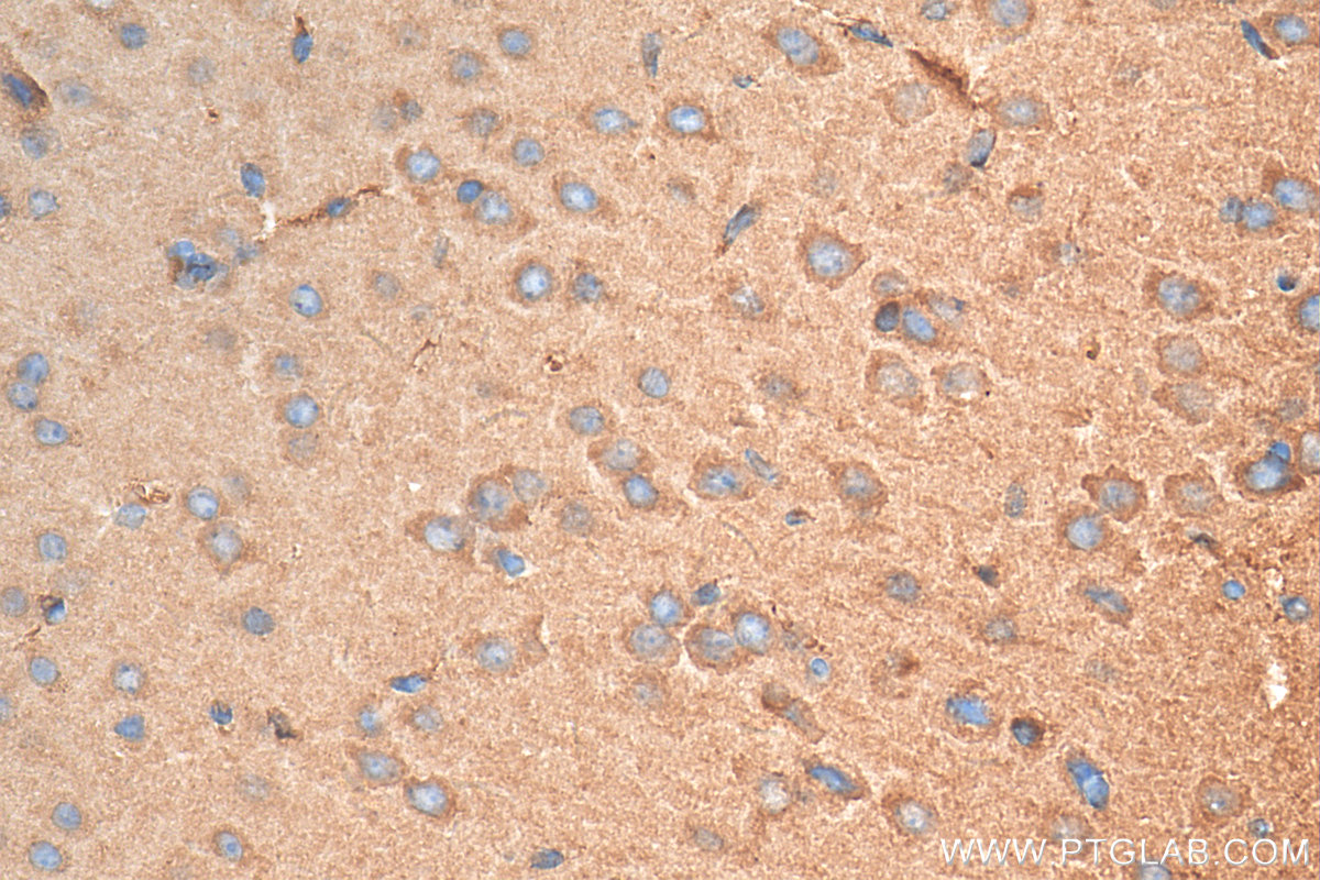IHC staining of mouse brain using 14820-1-AP