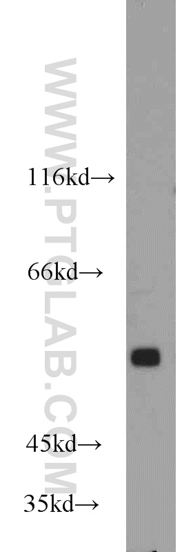 WB analysis of mouse brain using 14820-1-AP