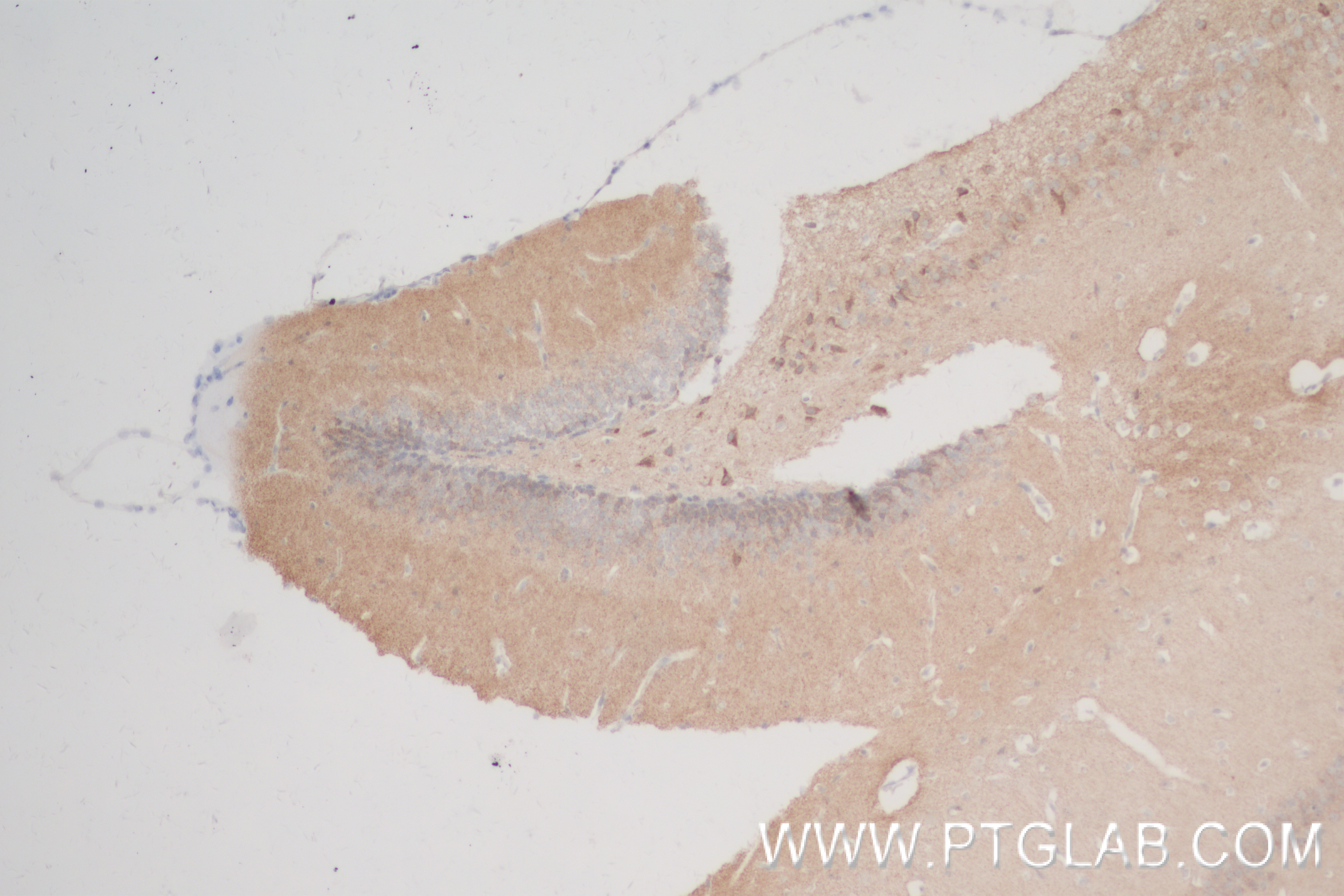 IHC staining of mouse brain using 84587-1-RR (same clone as 84587-1-PBS)
