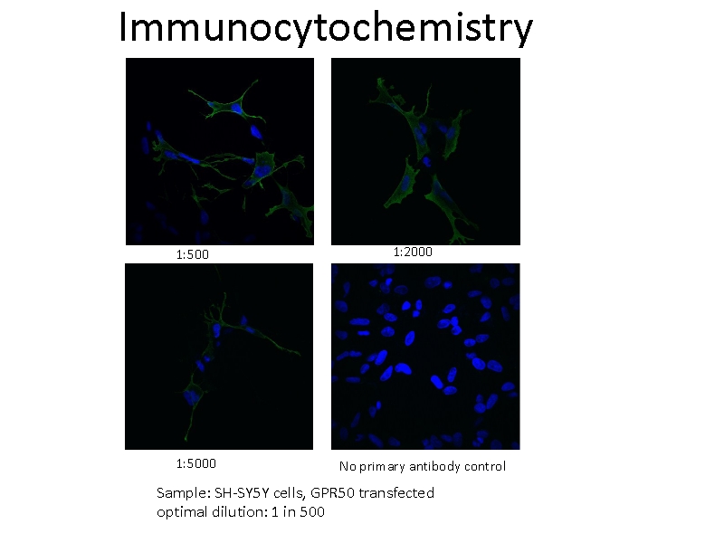 IF Staining of SH-SY5Y cells using 19762-1-AP