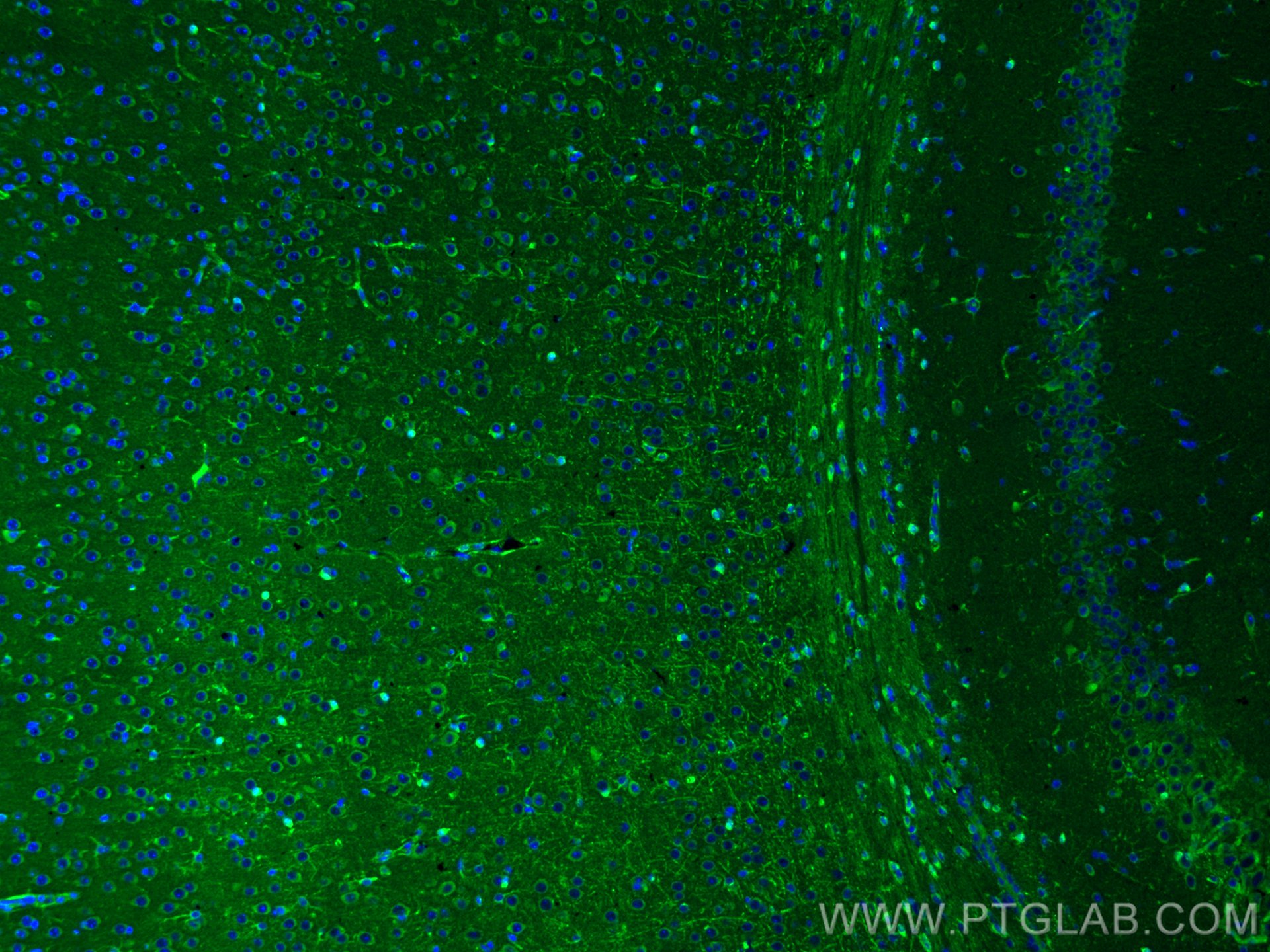 IF Staining of mouse brain using 19762-1-AP