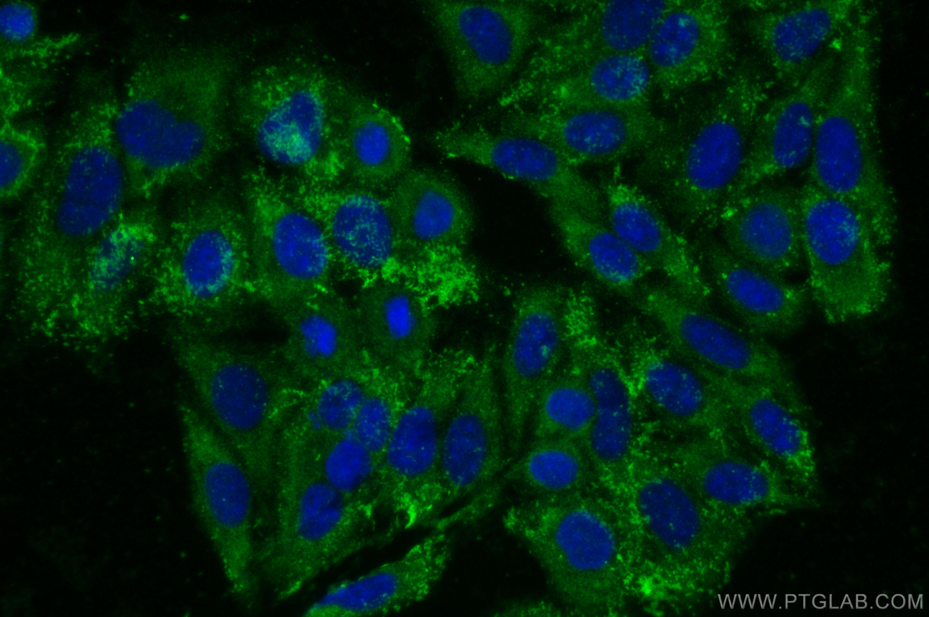 IF Staining of HepG2 using 30863-1-AP
