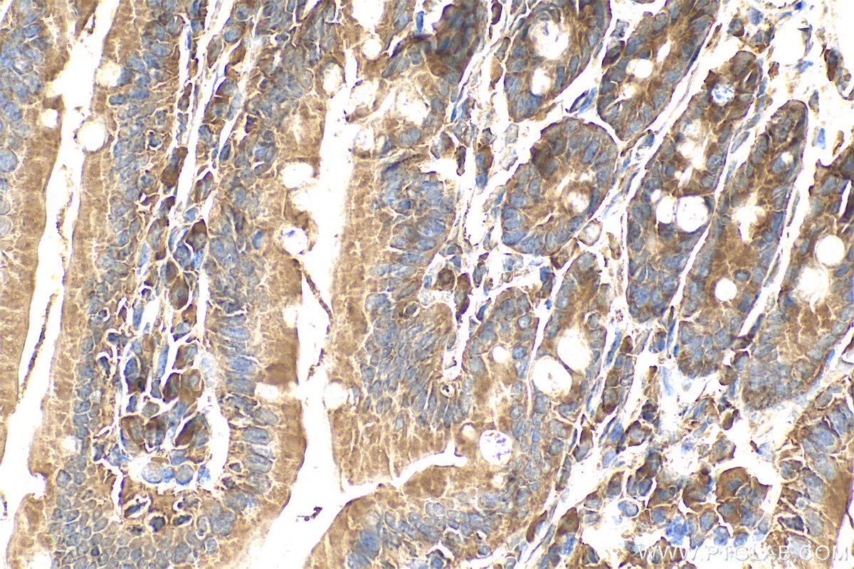 IHC staining of mouse small intestine using 30863-1-AP