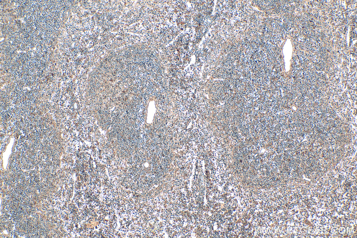 Immunohistochemical analysis of paraffin-embedded mouse spleen tissue slide using 20306-1-AP (GPR65 antibody) at dilution of 1:200 (under 10x lens). Heat mediated antigen retrieval with Tris-EDTA buffer (pH 9.0). IHC staining of mouse spleen using 20306-1-AP