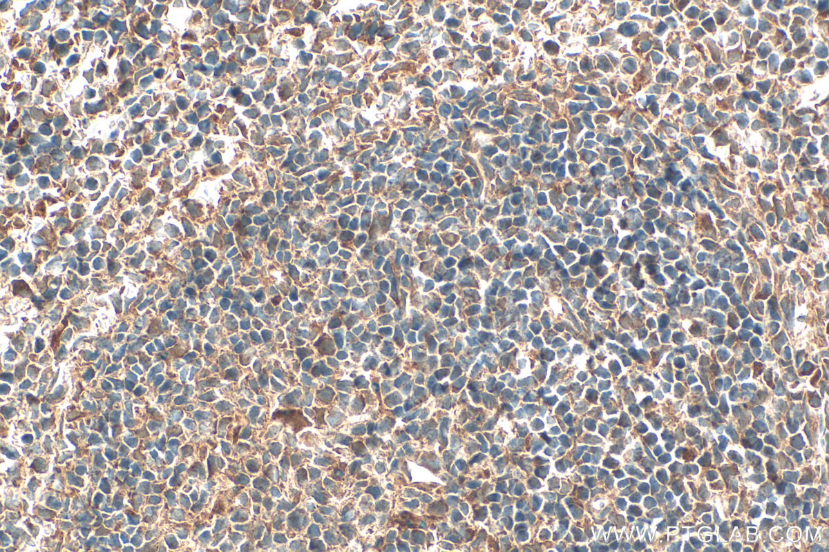 Immunohistochemical analysis of paraffin-embedded mouse spleen tissue slide using 20306-1-AP (GPR65 antibody) at dilution of 1:200 (under 40x lens). Heat mediated antigen retrieval with Tris-EDTA buffer (pH 9.0). IHC staining of mouse spleen using 20306-1-AP