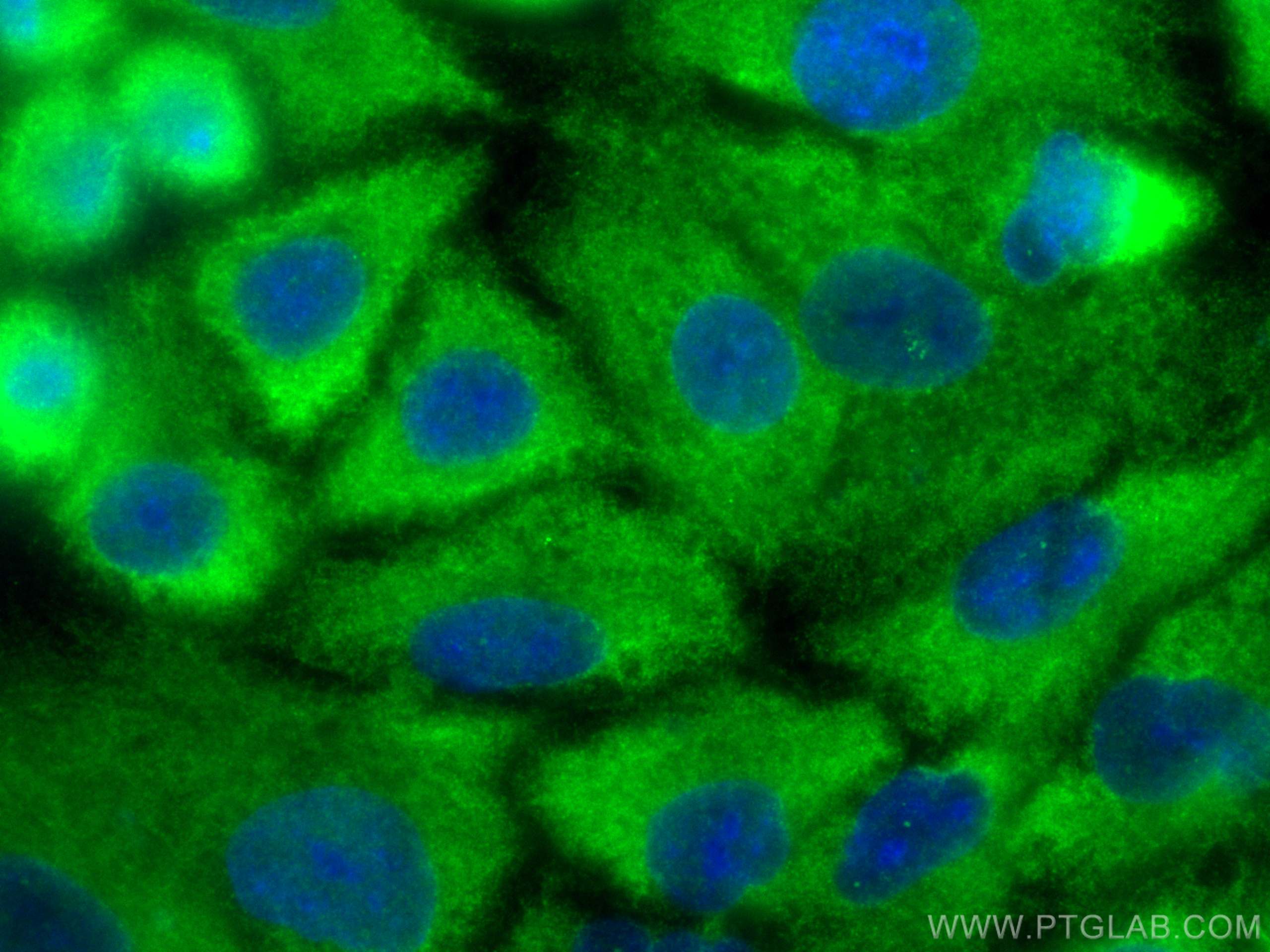 IF Staining of A549 using 17972-1-AP