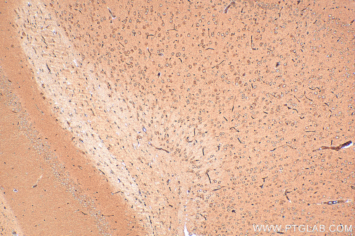 IHC staining of mouse brain using 17972-1-AP