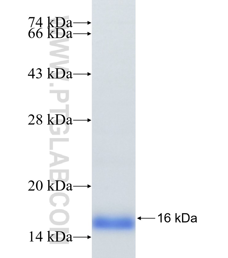 GPR77 fusion protein Ag34374 SDS-PAGE GPR77 fusion protein Ag34374 SDS-PAGE