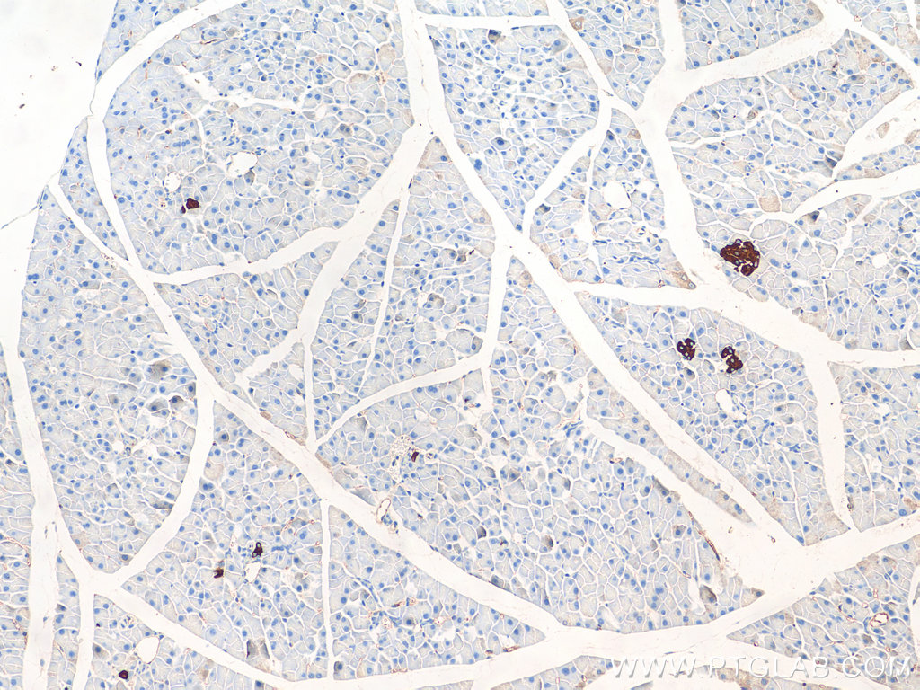 IHC staining of mouse pancreas using 20146-1-AP