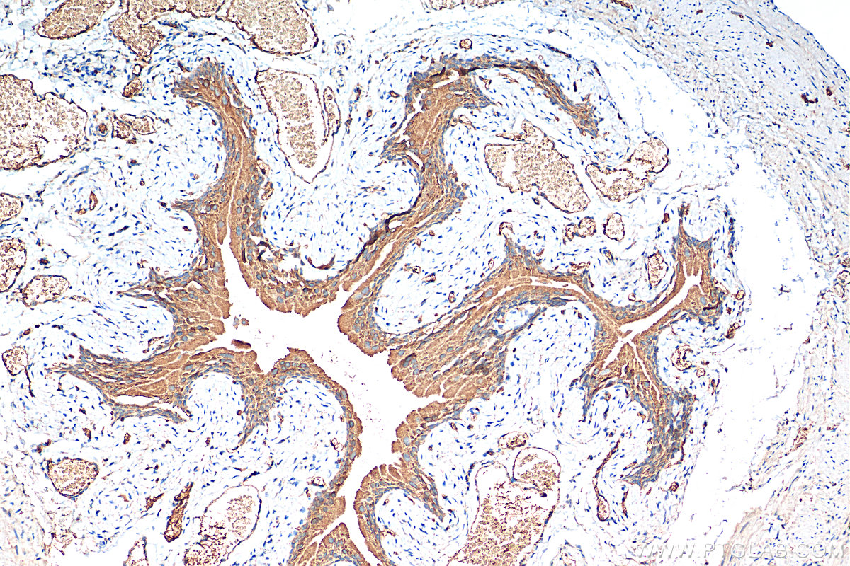 IHC staining of mouse bladder using 25999-1-AP