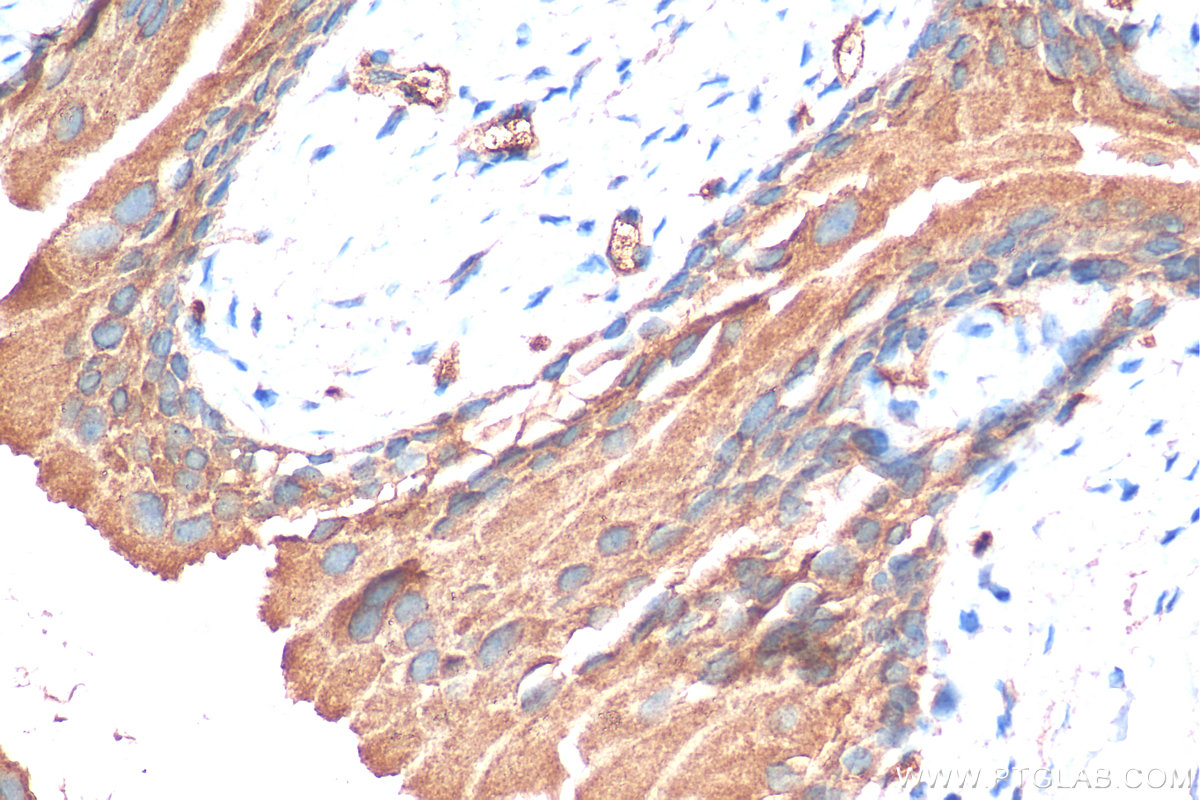 IHC staining of mouse bladder using 25999-1-AP