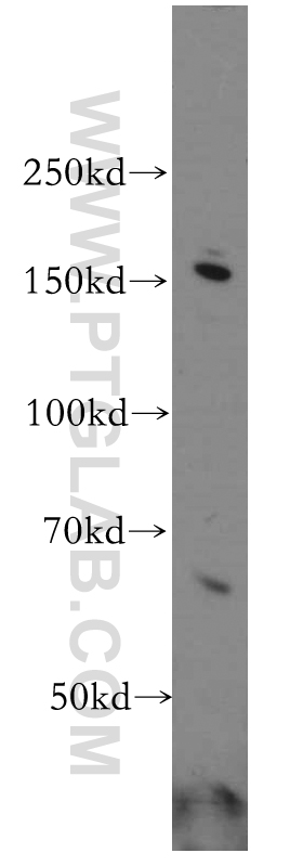 WB analysis of HeLa using 20020-1-AP