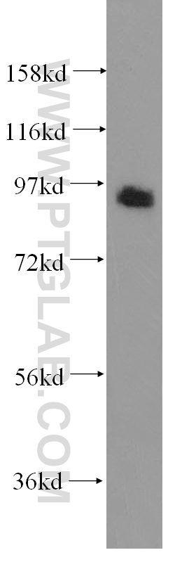 WB analysis of HEK-293 using 12159-1-AP