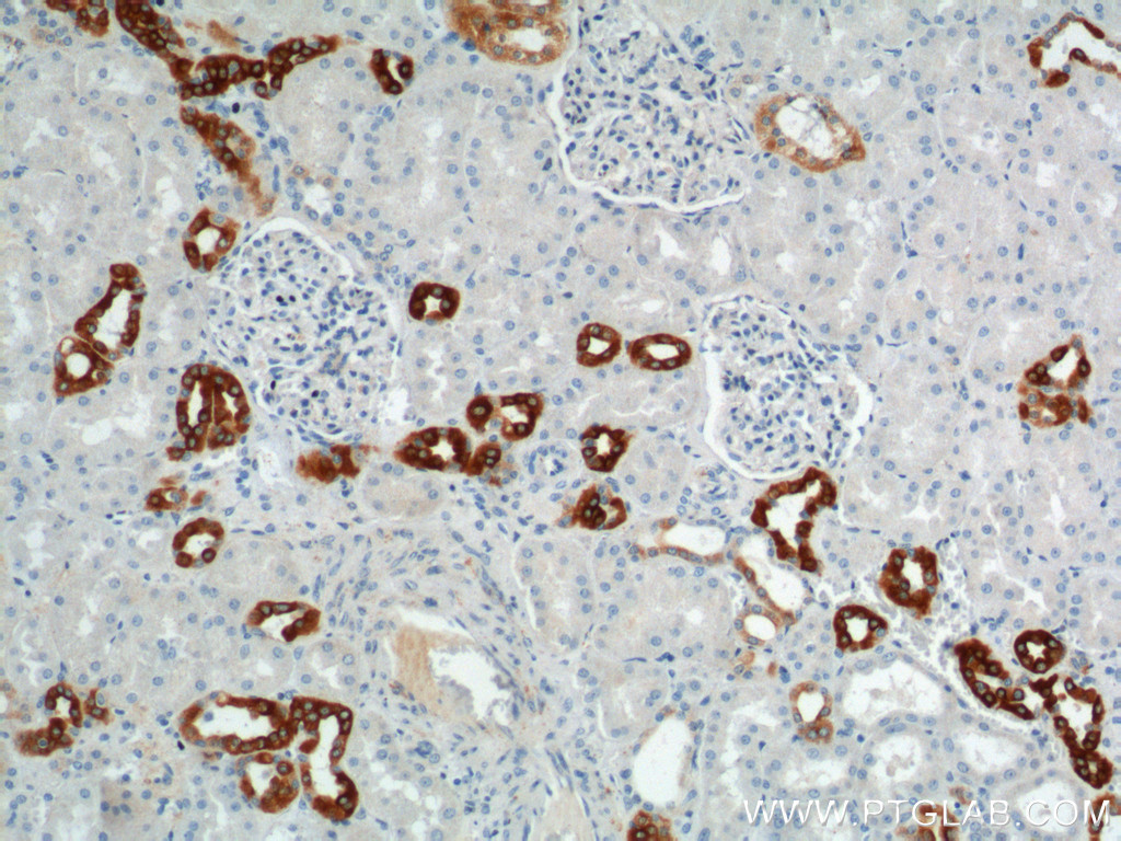 IHC staining of human kidney using 21089-1-AP