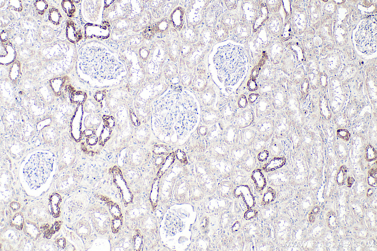 Immunohistochemical analysis of paraffin-embedded human kidney tissue slide using 21089-1-AP (GPRC5D antibody) at dilution of 1:200 (under 10x lens). Heat mediated antigen retrieval with Tris-EDTA buffer (pH 9.0). IHC staining of human kidney using 21089-1-AP