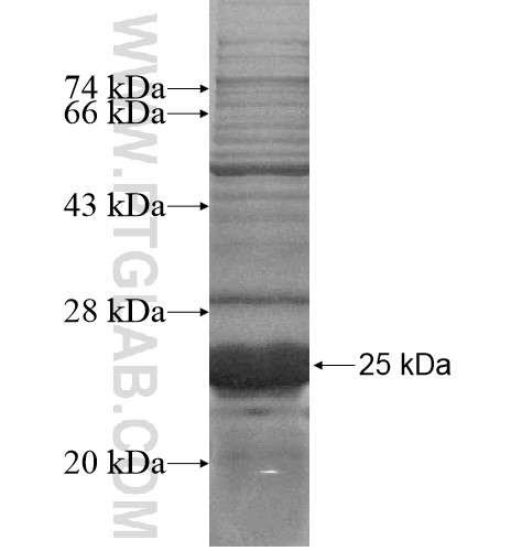 GPRC5D fusion protein Ag15215 SDS-PAGE GPRC5D fusion protein Ag15215 SDS-PAGE