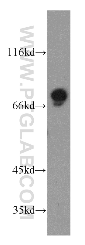 WB analysis of HeLa using 11483-1-AP