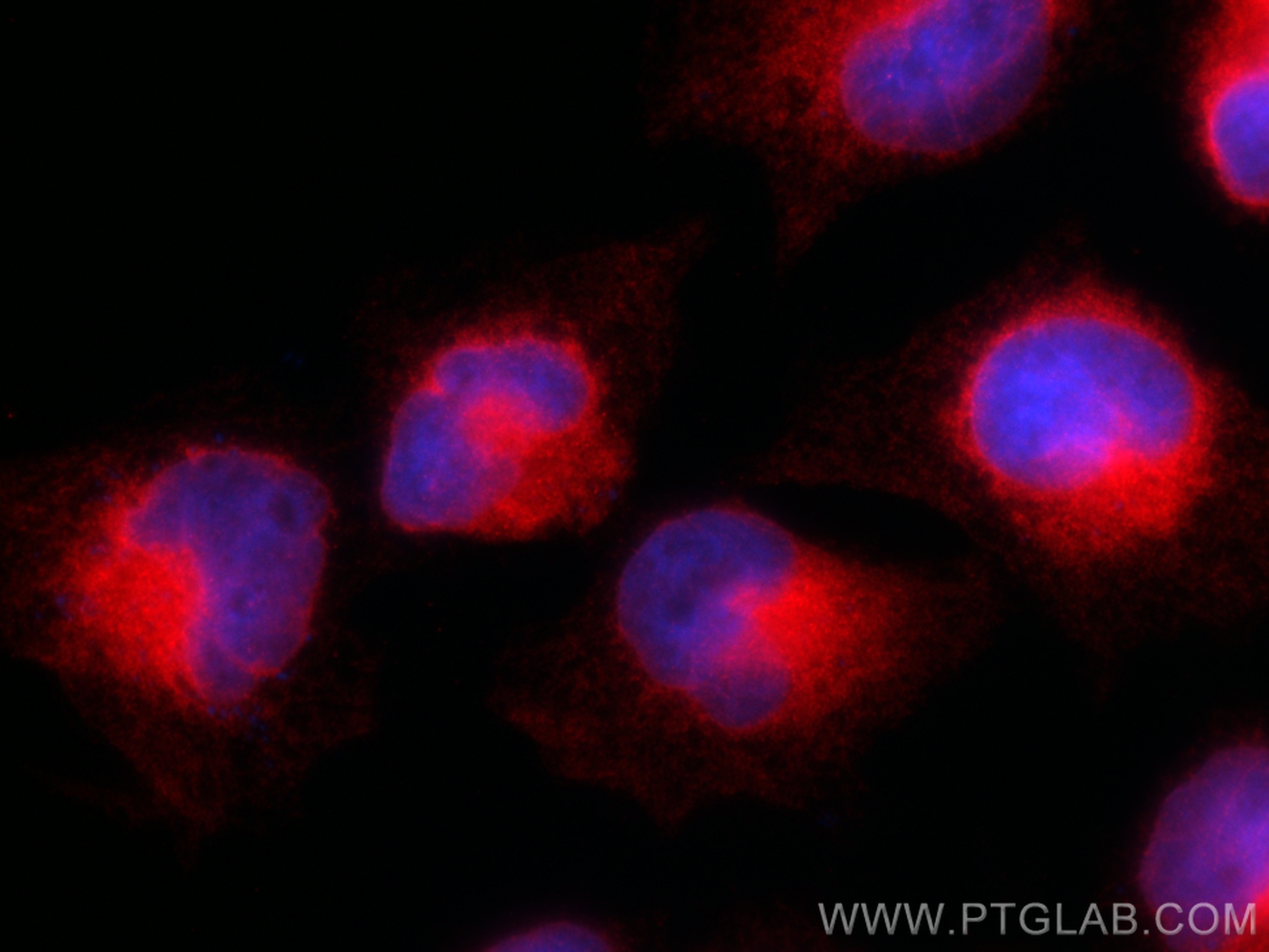 IF Staining of U-251 using 83592-4-RR (same clone as 83592-4-PBS)