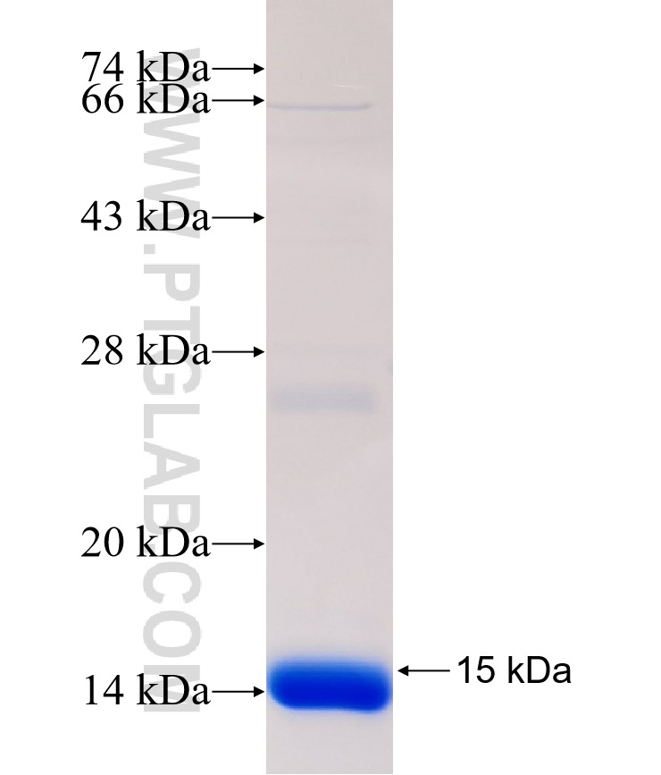 GPSN2 fusion protein Ag32591 SDS-PAGE GPSN2 fusion protein Ag32591 SDS-PAGE