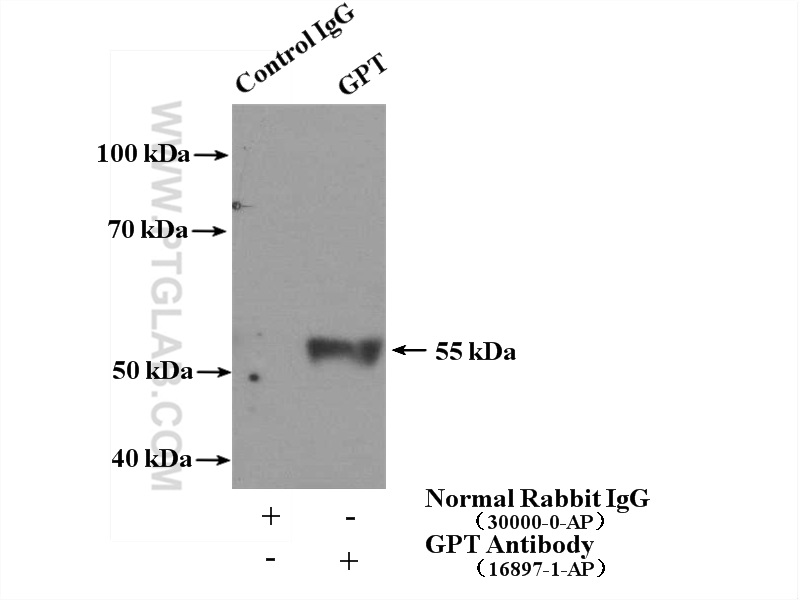 GPT / ALT1 Polyclonal antibody