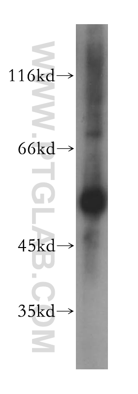 GPT / ALT1 Polyclonal antibody