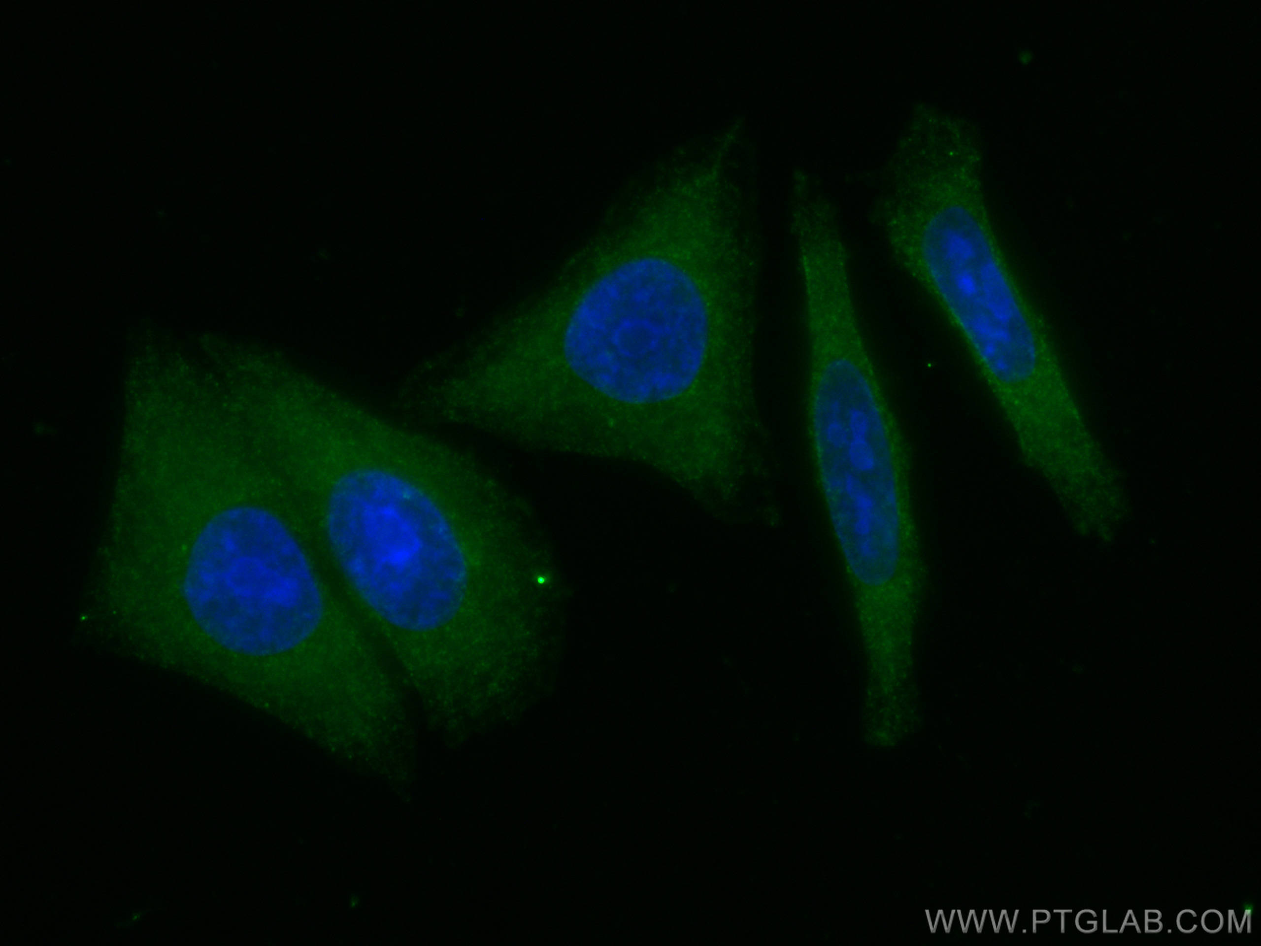 IF Staining of HepG2 using 67531-1-Ig