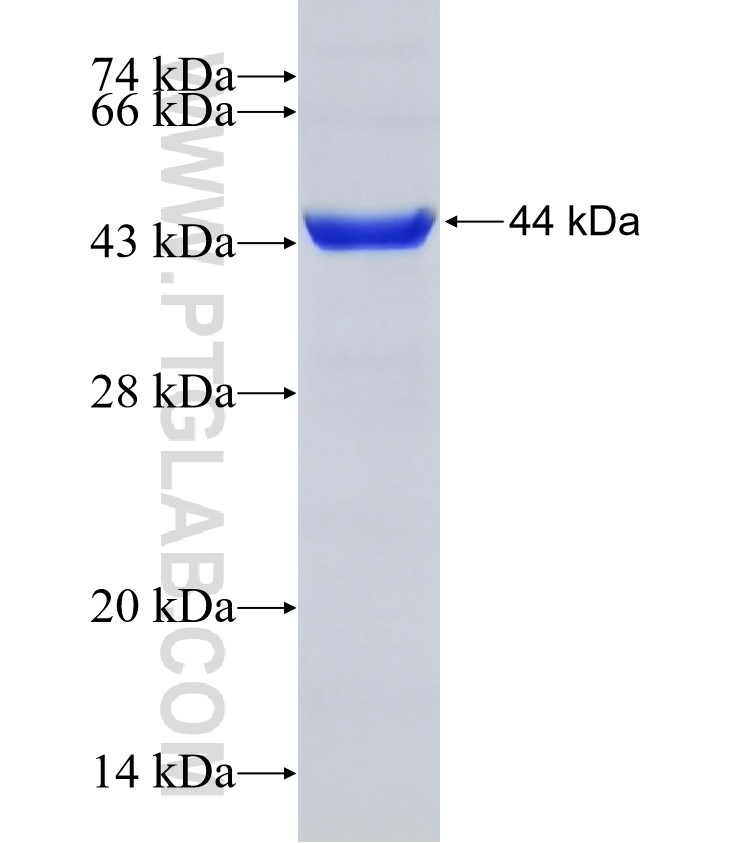 GPT fusion protein Ag10453 SDS-PAGE
