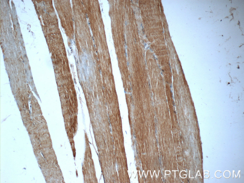 IHC staining of human skeletal muscle using 16757-1-AP