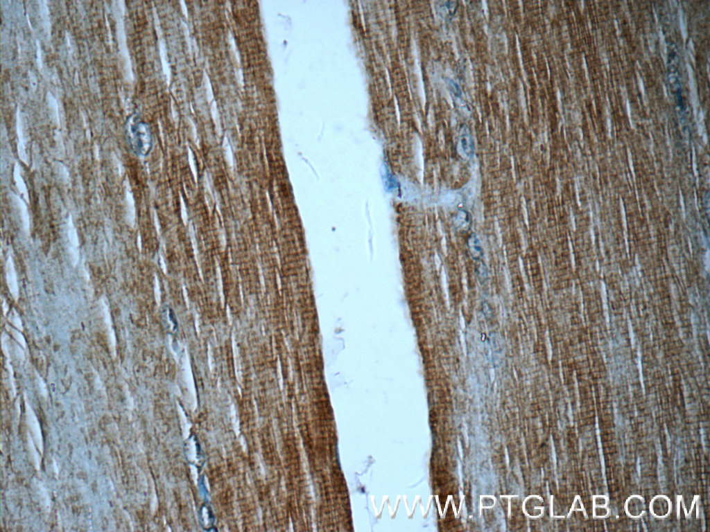 IHC staining of human skeletal muscle using 16757-1-AP