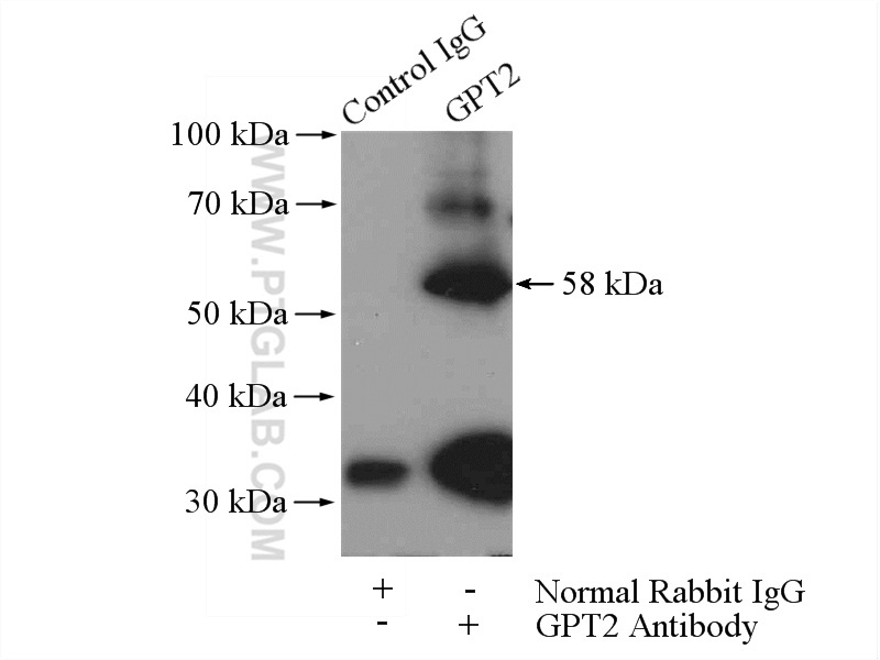 IP experiment of mouse kidney using 16757-1-AP