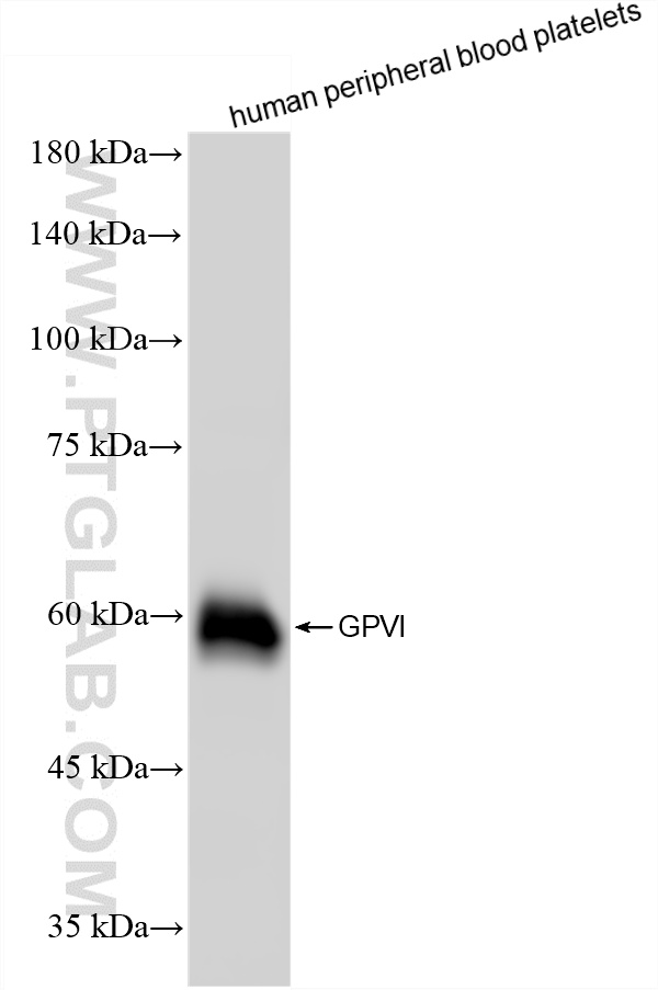 WB analysis of human peripheral blood platelets using 87275-3-RR (same clone as 87275-3-PBS)