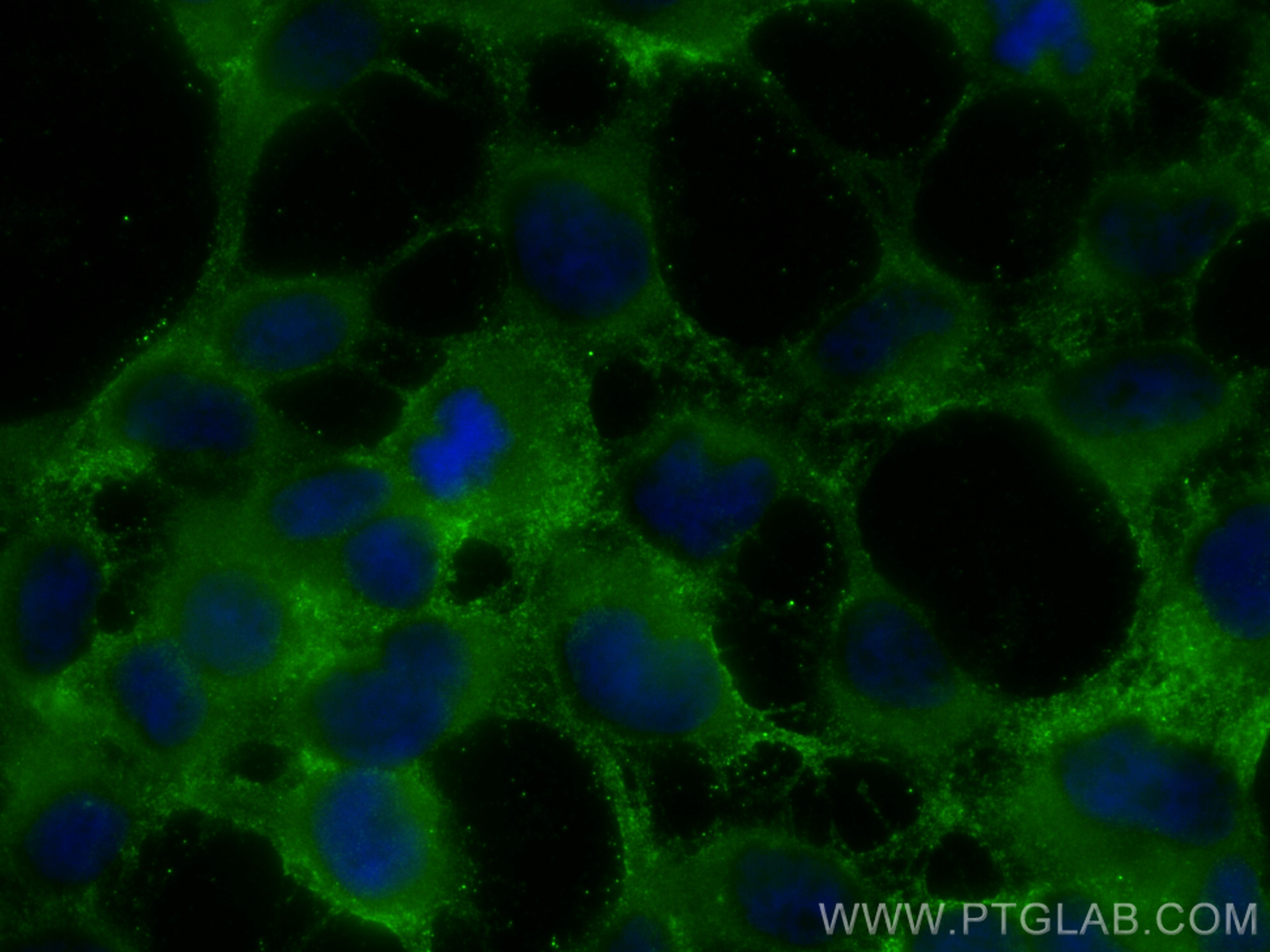 IF Staining of HEK-293 using 13947-1-AP